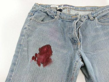Как убрать пятна крови с одежды?